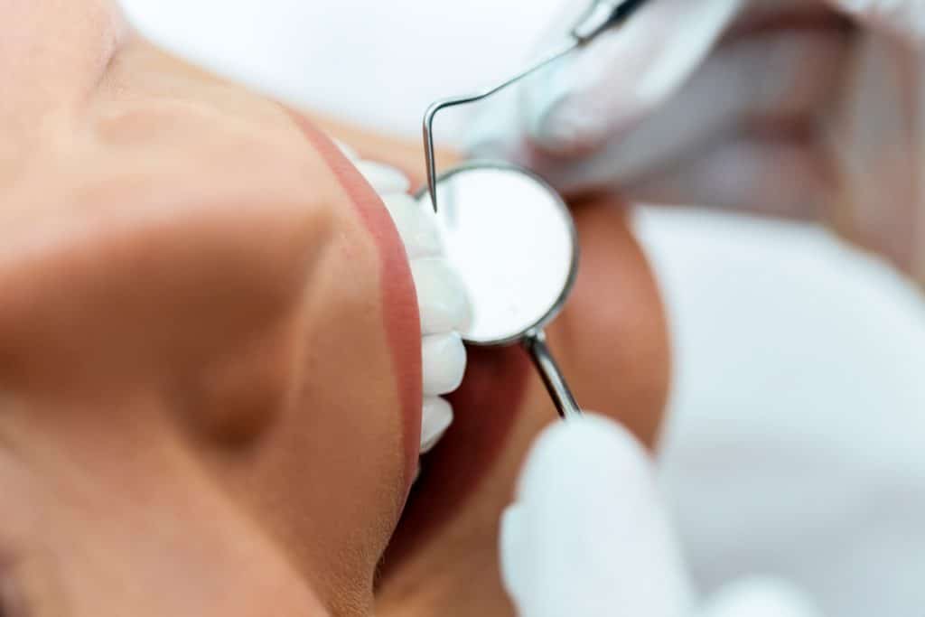How Much Do Porcelain Veneers Cost in Dickson, TN?